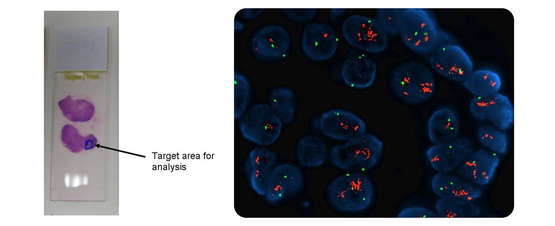 История онкогенетики 2
