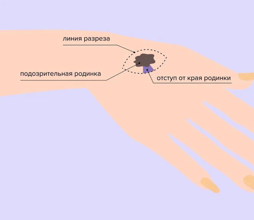 ris_1_biopsiia.width-826.format-webp